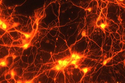 Connections between brain cells. NIH Image Gallery/Flickr, CC BY-NC